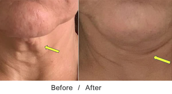 MAYACHIA THE ADVANCED RESPONSE COMPLEX FACE NECK CREAM 3