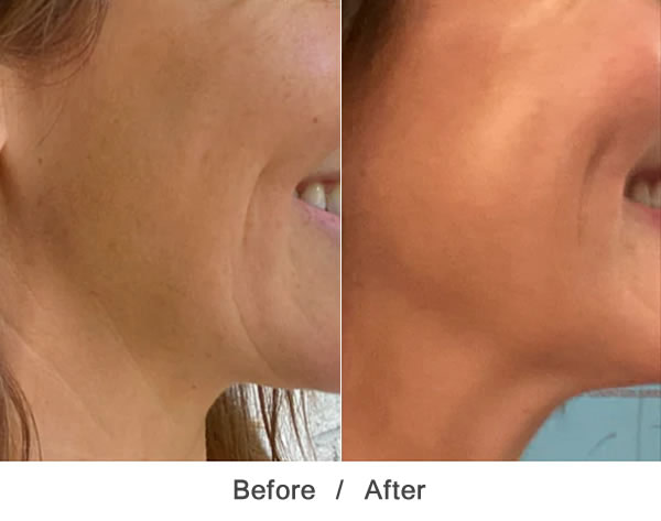 MAYACHIA THE ADVANCED RESPONSE COMPLEX FACE NECK CREAM 2