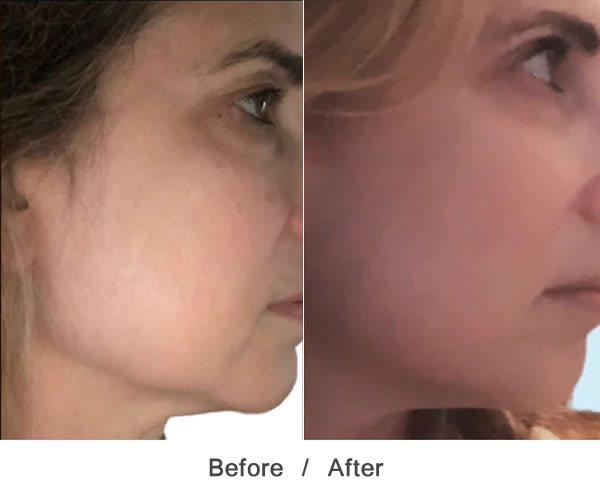 MAYACHIA THE ADVANCED RESPONSE COMPLEX FACE NECK CREAM 1