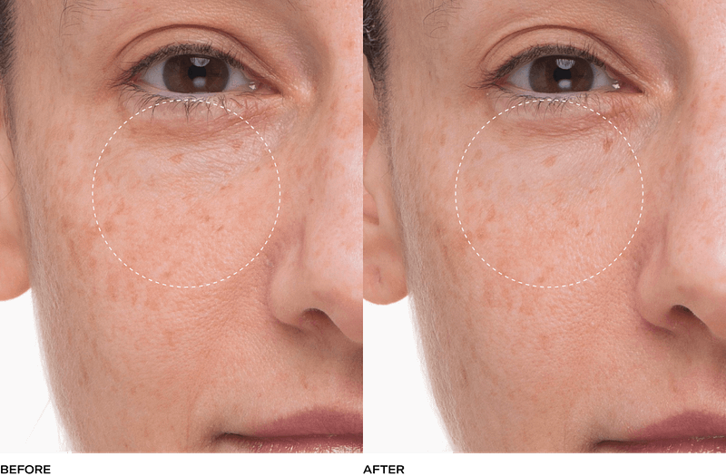 Plumtox e1760689832493