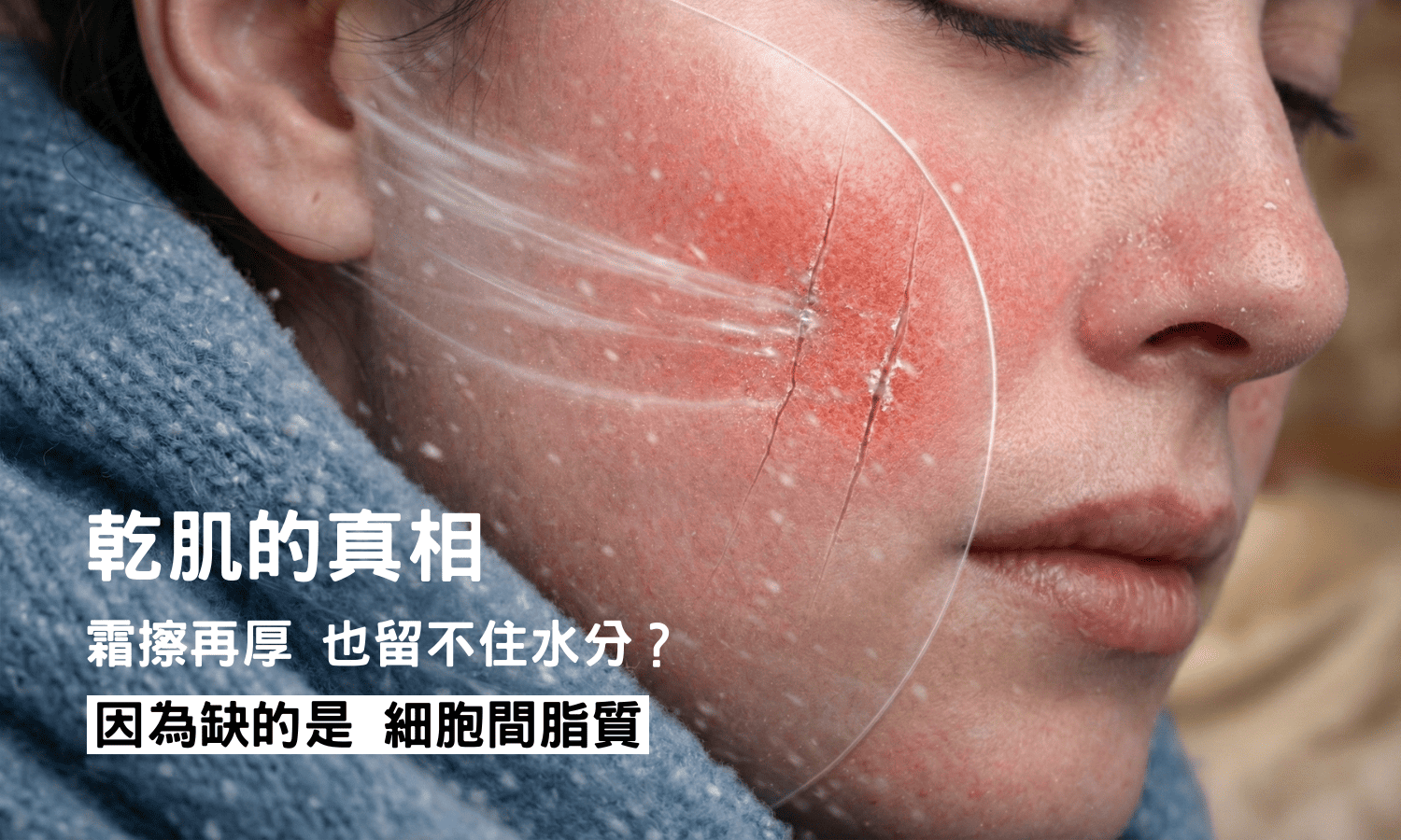 Skin Barrier Dry Skin 1500900